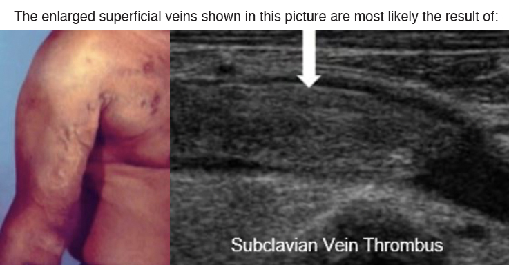 Where are the Best Vascular Ultrasound Training & CME Courses